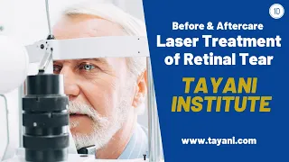 Laser Treatment of Retinal Tear | Tayani Institute