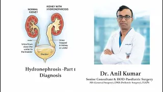 Dr. Anil Kumar on Hydronephrosis- Diagnosis | Sakra World Hospital