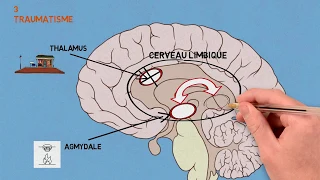 3- Les traumas: Traumatisme et conséquences sur le cerveau