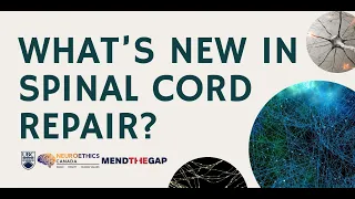 Community Conversations: What’s new in spinal cord repair? (June 7, 2022)