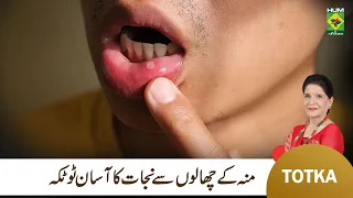 Zubaida Apa Totkay | Muh K Chalon Ka Ilaj | Mouth Ulcers Causes & Treatment | MasalaTv