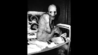 "Russian Sleep Experiment" - Creepypasta