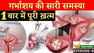 गर्भाशय की गाँठ (FIBROID) 1 बार में पूरी ख़त्म - Kaise ?? Ayurvedic Treatment of Fibroids in Hindi