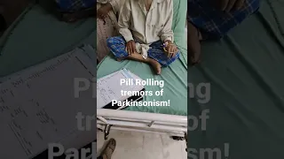 Pill Rolling Tremors of Parkinsonism!