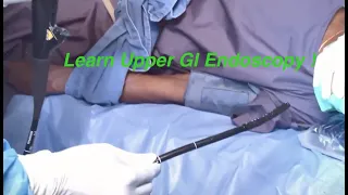 Steps of Diagnostic Upper GI Endoscopy - Dr S Easwaramoorthy