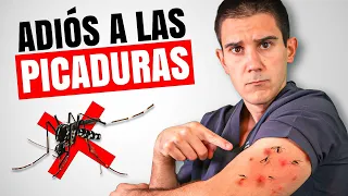 Te Revelo Cómo ERRADICAR las PICADURAS de MOSQUITO🦟 (Usa ESTO)