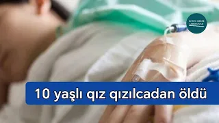 Bacı-qardaş qızılcaya yoluxdu, bacı vəfat etdi - Hadisə Belə Olub | Doğru Xəbər Az