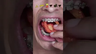 what happens when you eat spicy chips with braces!?