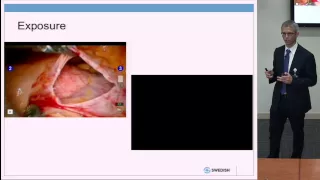 Surgical Technique in MIMVR: Direct vs. Endoscopic by Eric Lehr, M.D.