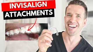 Don't get Invisalign Attachments Before watching this! | Dr. Nate
