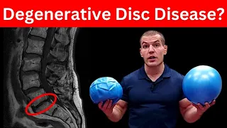 4 Must-Do Exercises For Degenerative Discs In Lower Back (Don't Skip These)