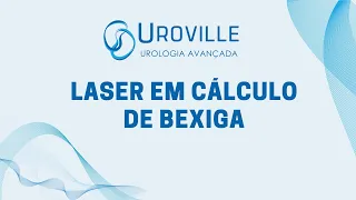 Laser em Cálculo de Bexiga