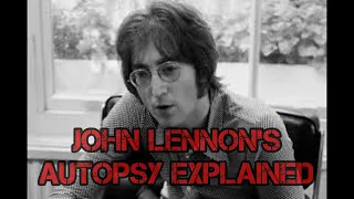 Famous Autopsies-John Lennon