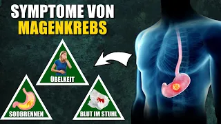 8 Symptome von Magenkrebs, die du nicht ignorieren solltest