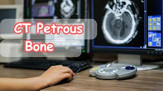 How to do ct Petrous bone التصوير المقطعى لعظام الأذن