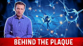 What is Plaque and How to Remove it Explained By Dr. Berg