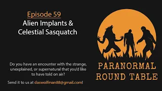 EP59 - Alien Implants & Celestial Sasquatch