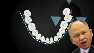 Errors in Clinical Practice｜【Chris Chang Ortho】CC421