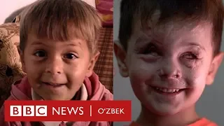Сурия уруши қурбонининг мурғак юзи - BBC Uzbek