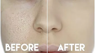 HOW TO HIDE ENLARGED PORES & MAKE YOUR PORES DISAPPEAR!