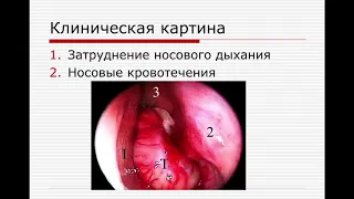 Доброкачественные и злокачественные образования ЛОР органов/Пороки развития ЛОР органов