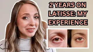 2 YEARS USING LATISSE: MY RESULTS | Any Negative Side Effects?  Is It Worth The Money?