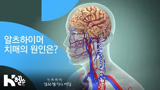 알츠하이머 치매의 원인 - (20181212_674회 방송) 누구도 예외일 수 없다 치매