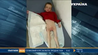 Справу проти батьків замореного голодом хлопця почали розглядати на Кіровоградщині