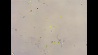 Хлорелла под микроскопом - 50 млн. клеток на мл.