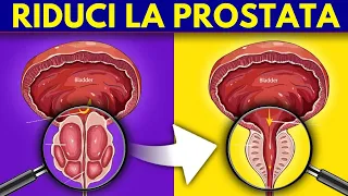 Come RIDURRE la PROSTATA in modo naturale: il NUTRIENTE n. 1 di cui hai bisogno