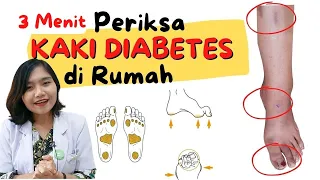 HOW TO EXAMINE DIABETES FEET AT HOME. ONLY 3 MINUTES!