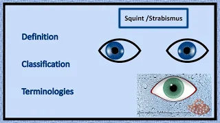 Squint  | Definition, Classification & Terminologies