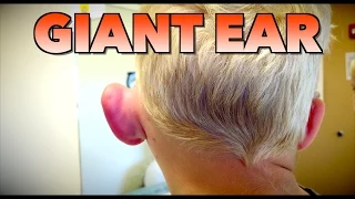 GIANT EAR: Allergic Reaction or Infection? | Dr. Paul