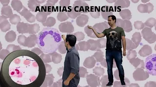 Anemias Carenciais, Aulão completo