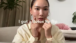 Life Updates ✨ I got a Botox Lip Flip 💉 | JANE CHUCK