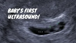 Baby's First Ultrasound! 6 Weeks Pregnant