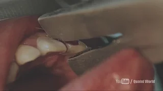 Painful Tooth Torture Mouth Horror Scene | Choi Min-sin, Kang Hye-Jung