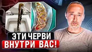 ГЛИСТЫ: Только ЭТИ травы и грибы уберут ВСЕХ паразитов из организма! Гельминты есть у всех: симптомы