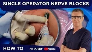 Single Operator Nerve Blocks