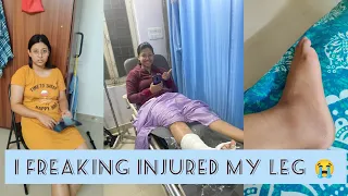 Chapter 2- Vlog 7 * I freaking injured my leg 🦵🥲*
