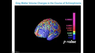 Early Detection and Prevention of Psychotic Disorders: Ready for “Prime Time”?