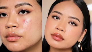 how to look like a "filter" in REAL LIFE with makeup (acne prone skin)