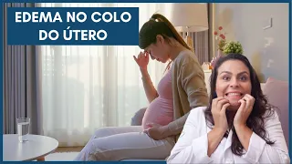 Edema no colo do útero | Dra. Maíra de La Rocque