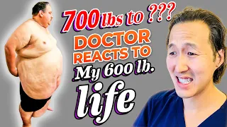 Plastic Surgeon Reacts to MY 600 LB LIFE! How Much Can He Lose?