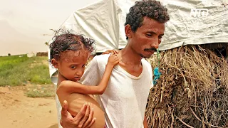 ООН: почти 100 тысячам детей в Йемене грозит смерть из-за недоедания