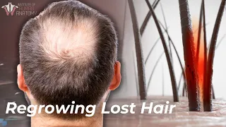 The Science of Hair Loss: How to Prevent & Regrow Lost Hair