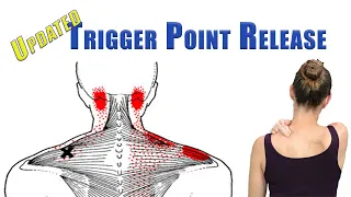 TRIGGER POINT RELEASE Upper Trapezius, Levator Scapulae, and Suboccipitals | UPDATED with back view