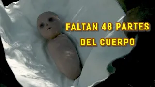 BEBÉ NACIDO SIN 48 PARTES DEL CUERPO |Resumen de película: DORORO