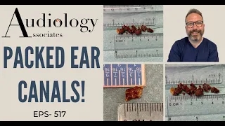JAM PACKED EAR WAX REMOVAL - EP517