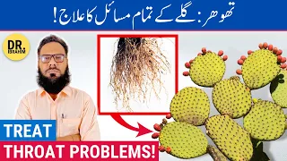 Thorr/Nagphani Ke Fayde - Treat All Throat Problems With Prickly Pear Cactus - Urdu/Hindi